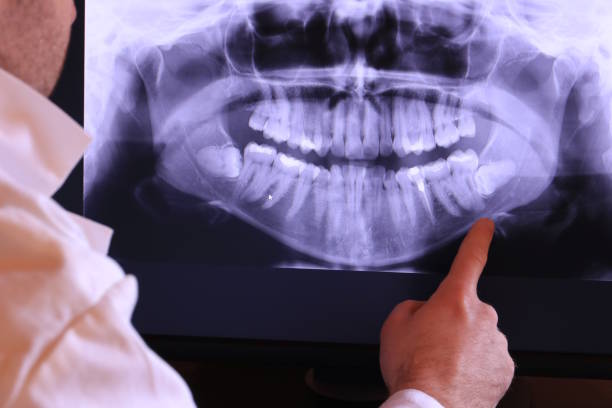 Best Holiday Emergency Dentist in Sedro Woolley, WA